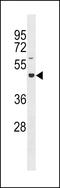 Glucoside Xylosyltransferase 2 antibody, LS-C157775, Lifespan Biosciences, Western Blot image 