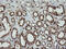 Phosphogluconate Dehydrogenase antibody, M01623, Boster Biological Technology, Immunohistochemistry paraffin image 