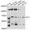 Adrenocortical dysplasia protein homolog antibody, abx125486, Abbexa, Western Blot image 