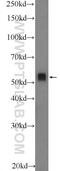 Tyrosine Hydroxylase antibody, 25859-1-AP, Proteintech Group, Enzyme Linked Immunosorbent Assay image 