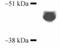 Cytochrome P450 Family 3 Subfamily A Member 4 antibody, LS-C36104, Lifespan Biosciences, Western Blot image 
