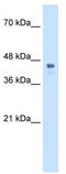 Homeobox C10 antibody, TA330641, Origene, Western Blot image 