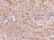 HSP90AA1 antibody, 106156-T08, Sino Biological, Immunohistochemistry paraffin image 