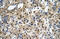 Squalene monooxygenase antibody, ARP42101_P050, Aviva Systems Biology, Immunohistochemistry paraffin image 