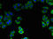Zinc Finger DHHC-Type Containing 15 antibody, LS-C397735, Lifespan Biosciences, Immunofluorescence image 