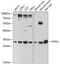 Sideroflexin 1 antibody, GTX66147, GeneTex, Western Blot image 