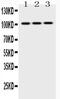 Hexokinase 2 antibody, PA5-79364, Invitrogen Antibodies, Western Blot image 
