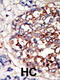 Dual specificity tyrosine-phosphorylation-regulated kinase 1B antibody, 62-970, ProSci, Immunohistochemistry paraffin image 
