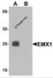 Homeobox protein EMX1 antibody, 6625, ProSci, Western Blot image 