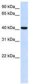 Acyl-CoA Wax Alcohol Acyltransferase 2 antibody, TA335288, Origene, Western Blot image 