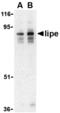 Lipase E, Hormone Sensitive Type antibody, MBS150842, MyBioSource, Western Blot image 