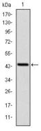 LIM Zinc Finger Domain Containing 1 antibody, GTX60472, GeneTex, Western Blot image 