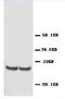 TIMP Metallopeptidase Inhibitor 4 antibody, AP23356PU-N, Origene, Western Blot image 