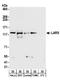 Leucyl-tRNA synthetase, cytoplasmic antibody, A304-316A, Bethyl Labs, Western Blot image 