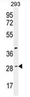 Chromosome 19 Open Reading Frame 38 antibody, AP50512PU-N, Origene, Western Blot image 