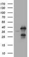 Ubiquitin Conjugating Enzyme E2 J1 antibody, TA504969AM, Origene, Western Blot image 