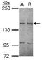 Ret Proto-Oncogene antibody, GTX111327, GeneTex, Western Blot image 