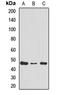Ribosomal Protein L4 antibody, LS-C668591, Lifespan Biosciences, Western Blot image 