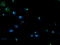 Phosphoglycerate Mutase 2 antibody, TA503403, Origene, Immunofluorescence image 