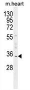 Uridine Phosphorylase 2 antibody, AP54478PU-N, Origene, Western Blot image 