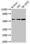 Potassium Voltage-Gated Channel Subfamily A Member Regulatory Beta Subunit 1 antibody, LS-C670525, Lifespan Biosciences, Western Blot image 