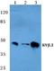 Ckbeta3 antibody, A14634-1, Boster Biological Technology, Western Blot image 
