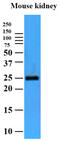 Peptidyl-prolyl cis-trans isomerase FKBP14 antibody, MBS200191, MyBioSource, Western Blot image 