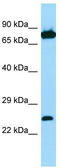 Sorting nexin-27 antibody, TA337959, Origene, Western Blot image 