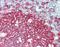 CD20 antibody, orb195416, Biorbyt, Immunohistochemistry paraffin image 