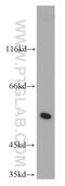 Leucine-rich repeat and death domain-containing protein antibody, 12119-1-AP, Proteintech Group, Western Blot image 
