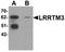 Leucine-rich repeat transmembrane neuronal protein 3 antibody, orb75563, Biorbyt, Western Blot image 