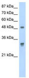 DDX19B antibody, TA345740, Origene, Western Blot image 