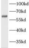 Leiomodin 3 antibody, FNab04809, FineTest, Western Blot image 
