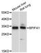 BPI Fold Containing Family A Member 1 antibody, A8634, ABclonal Technology, Western Blot image 