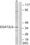 Diacylglycerol O-Acyltransferase 2 Like 6 antibody, LS-C119903, Lifespan Biosciences, Western Blot image 