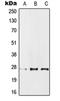 Protein Phosphatase 1 Regulatory Inhibitor Subunit 1A antibody, orb215507, Biorbyt, Western Blot image 