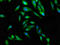 Centrosomal protein of 97 kDa antibody, LS-C672632, Lifespan Biosciences, Immunofluorescence image 