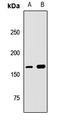Uveal Autoantigen With Coiled-Coil Domains And Ankyrin Repeats antibody, orb412879, Biorbyt, Western Blot image 