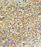 UDP-glucuronosyltransferase 2B17 antibody, 62-285, ProSci, Immunohistochemistry paraffin image 