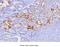 Fatty Acid Binding Protein 1 antibody, GTX53712, GeneTex, Immunohistochemistry paraffin image 