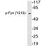 FYN Proto-Oncogene, Src Family Tyrosine Kinase antibody, LS-C291503, Lifespan Biosciences, Western Blot image 