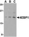 Eukaryotic Translation Initiation Factor 4E Binding Protein 1 antibody, TA306222, Origene, Western Blot image 