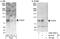 Forkhead box protein P4 antibody, A302-394A, Bethyl Labs, Immunoprecipitation image 