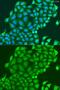 HAUS Augmin Like Complex Subunit 6 antibody, GTX65582, GeneTex, Immunofluorescence image 