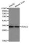 Voltage-dependent anion-selective channel protein 2 antibody, LS-C335386, Lifespan Biosciences, Western Blot image 