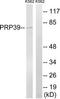 Pre-MRNA Processing Factor 39 antibody, TA315559, Origene, Western Blot image 