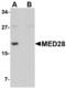 Mediator of RNA polymerase II transcription subunit 28 antibody, A08611, Boster Biological Technology, Western Blot image 