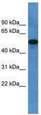 Cytochrome P450 Family 11 Subfamily B Member 1 antibody, TA342857, Origene, Western Blot image 