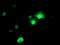 AP2M1 antibody, MA5-25570, Invitrogen Antibodies, Immunocytochemistry image 