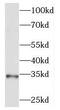 Mesoderm Specific Transcript antibody, FNab05132, FineTest, Western Blot image 